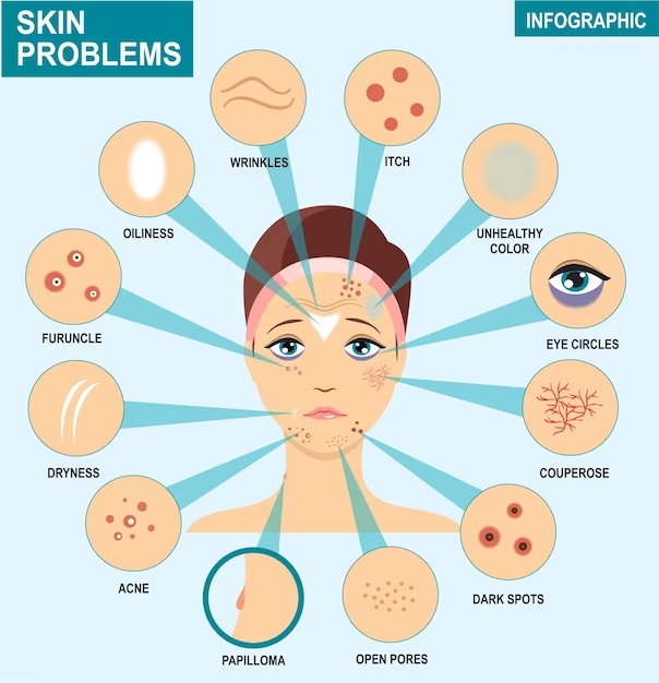 The Top Most Common Skin Problems and How to Treat Them