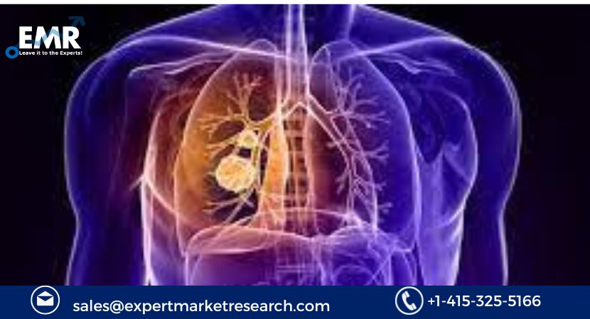 Thoracic Surgery Market Size, Growth 2024-2032